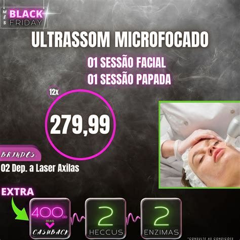 Sessão facial Massagem erótica Sao Bras De Alportel